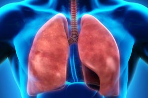 Pulmonary Embolism is The Leading Cause of Preventable Deaths in Patients Hospitalized for Surgical Procedures