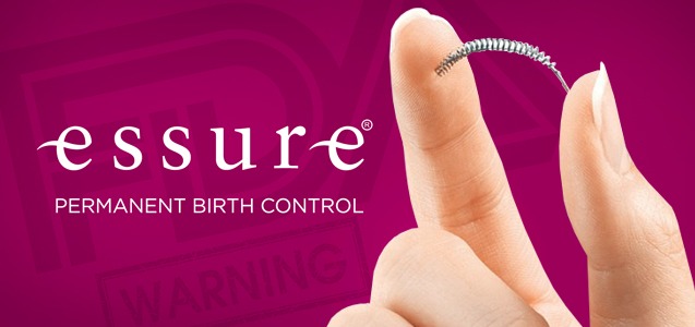 Study Shows Essure Users Are 10x More Likely to Require Post-Procedure Surgery