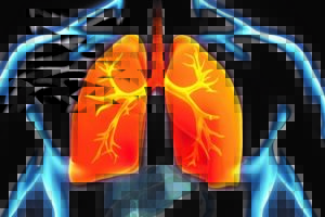 Medical Professionals Often Fail to Diagnose Pulmonary Embolism