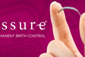 Essure: The Controversy Behind this Female Sterilization Device