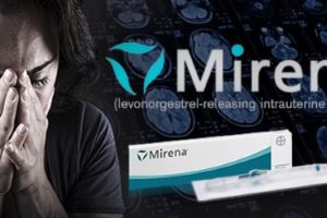 Mirena IUD: The FDA and Bayer Pharmaceuticals