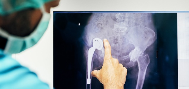 X-Ray of hip implant