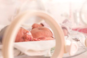 Seizures in Newborns