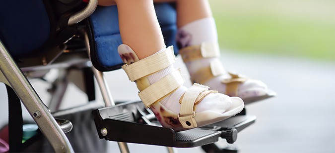 Spastic Quadriplegia: What Is It and Why Does It Happen?