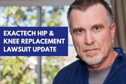 Exactech Hip Replacement Lawsuit Update 2023