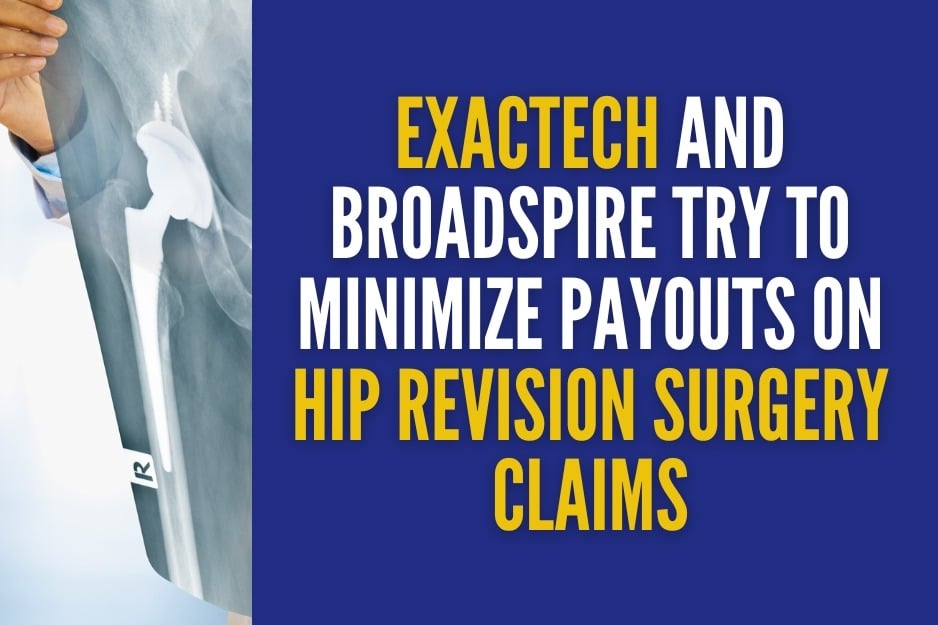 Update on Exactech Hip Replacement Recall Lawsuits