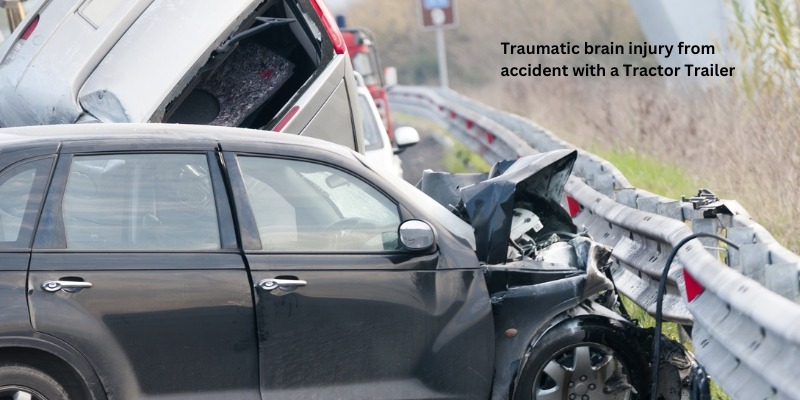 Traumatic brain injury from accident with a Tractor Trailer
