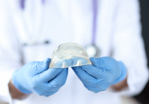 Allergan’s Defective Textured Breast Implants: A Brief Update on the BIA-ALCL Litigation