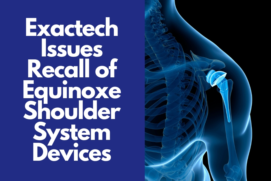 Exactech Issues Equinoxe Shoulder Replacement Recall