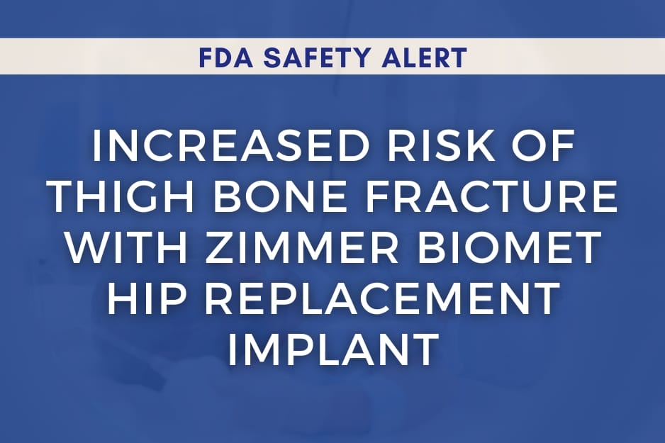 Increased Risk of Thigh Bone Fracture with Zimmer Biomet Hip Replacement Implant